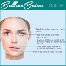 Curso Online de Tratamientos Alternativos para Parálisis Facial